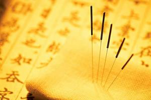 捨我心晴 針有所感