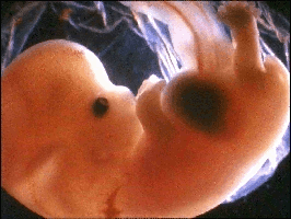 7wkfetus.gif (38196 bytes)