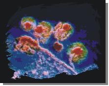 hiv.JPG (8233 bytes)