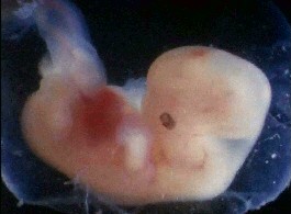 56wkfet.gif (34221 bytes)